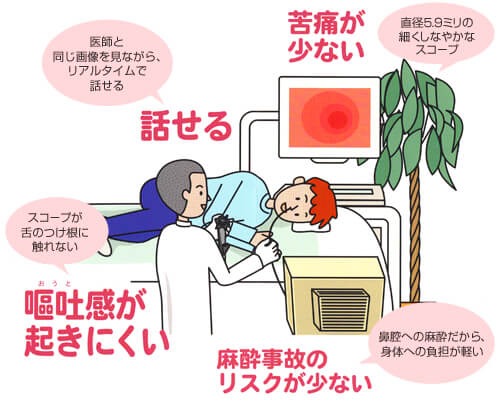 経鼻内視鏡検査の特長